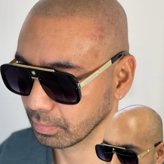 🔥The best scalp micropigmentation is the kind nobody notices. They just think you have a fuller hea