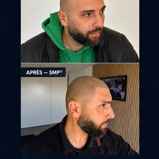 #RecrutementLyon #EmploiLyon #SMPLyon #SMPFrance