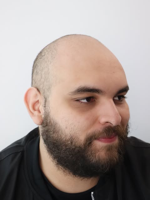 Traitement crâne rasé en SMP® ultra-réaliste ✨

Reproduction précise de milliers de follicules pileu