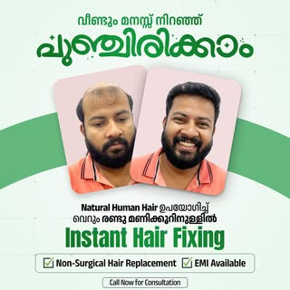 മുടി കൊഴിച്ചിൽ കാരണം ആത്മവിശ്വാസം നഷ്ടപ്പെട്ടോ? 😟

ഇനി Instant Hair Fixing ഉപയോഗിച്ച് വെറും 2 മണിക്
