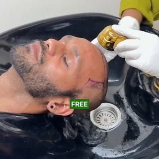 FOLLOW US AND FILL THE FORM IN BIO 🚨

Want a FREE hair transplant treatment? Yes, you read that rig