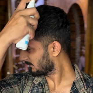 Every great transformation begins with a single step. ✨

This is Mr. Suhel Khan's hair restoration j