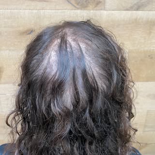 The CNC hair system is designed to help you go through life with more confidence! It helps you stop 
