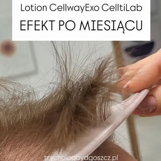 Lotion CellwayExo w akcji = piękne babyhair. Ale mnóstwo pracy jeszcze przed nami. Na kontroli wprow