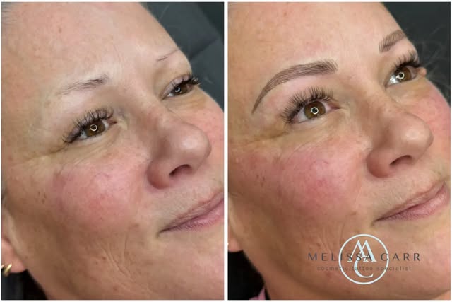 From non-existent brows to beautifully, undetectably tattooed brows ✨

Mapped, measured and bespoke-