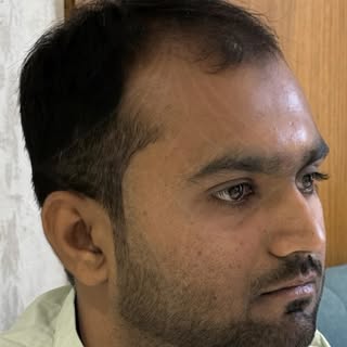 It’s not just about hair. It’s about how you feel.

Book your hair transplant at Bellisima Clinic to