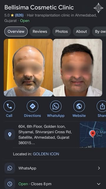 Every hair transplant is a journey toward a more natural and fuller appearance.

Book your hair tran