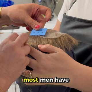A lot of men are surprised by what’s actually possible today.

Hair systems aren’t what they used to