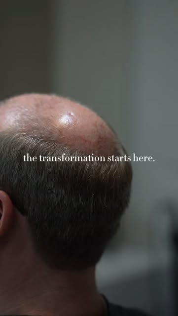 It starts with the details. ✨

A natural-looking hair system isn’t one-size-fits-all. Every detail m