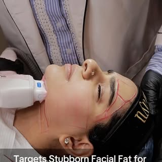 Sometimes we don’t realize how much facial puffiness and sagging can affect the way we feel about ou