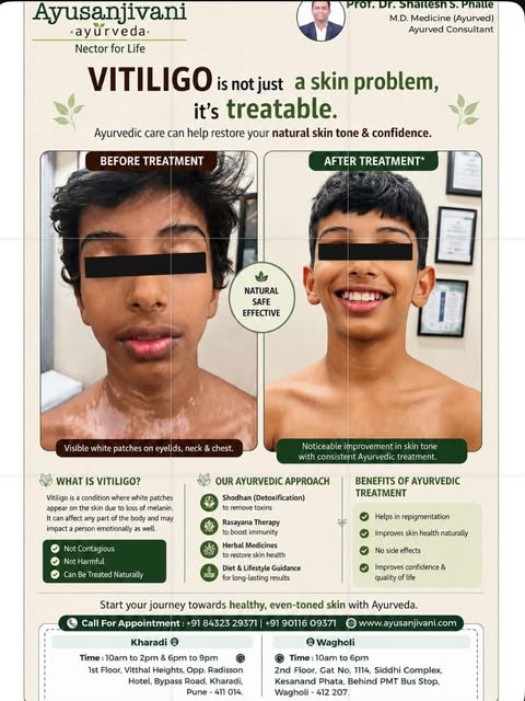 A journey of patience, consistency & care. 🌿✨ Explore this vitiligo treatment journey and hear the 