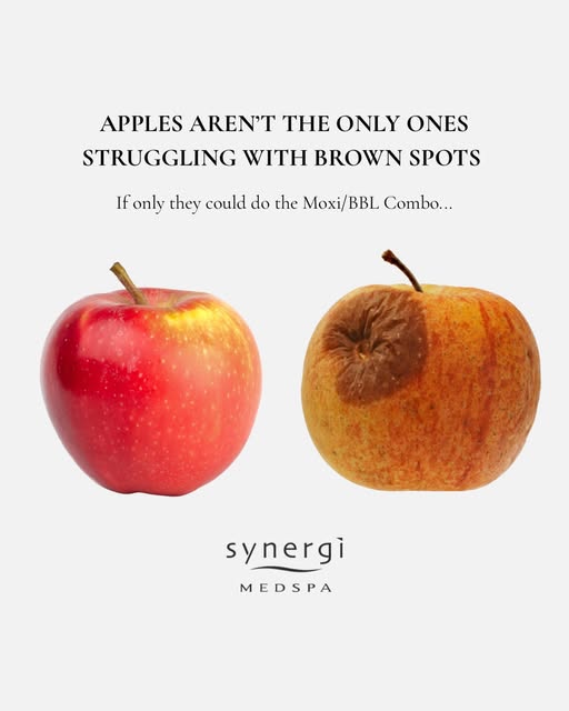Apples aren’t the only ones that struggle with brown spots. 🍎👀

Sun exposure, hormones, and time c