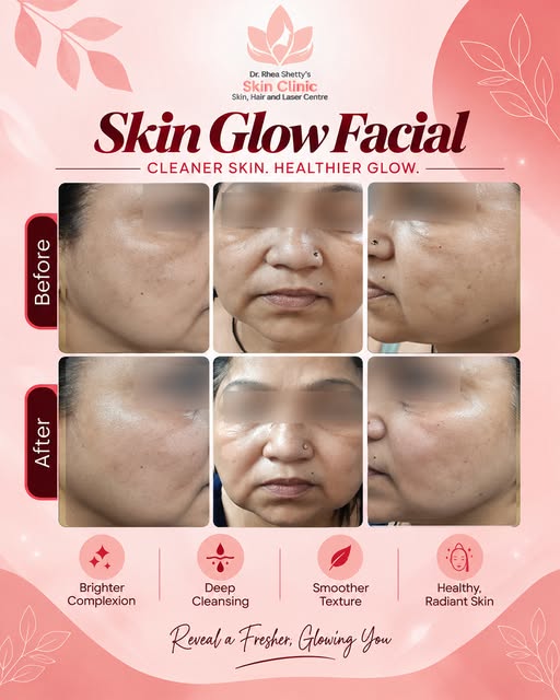 ✨ Reveal your skin’s natural glow with professional care. ✨

A refreshed look begins with healthy, w