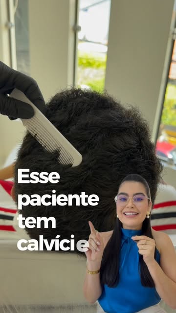 A alopecia androgenética é uma condição que não tem cura, mas com o tratamento ideal conseguimos con