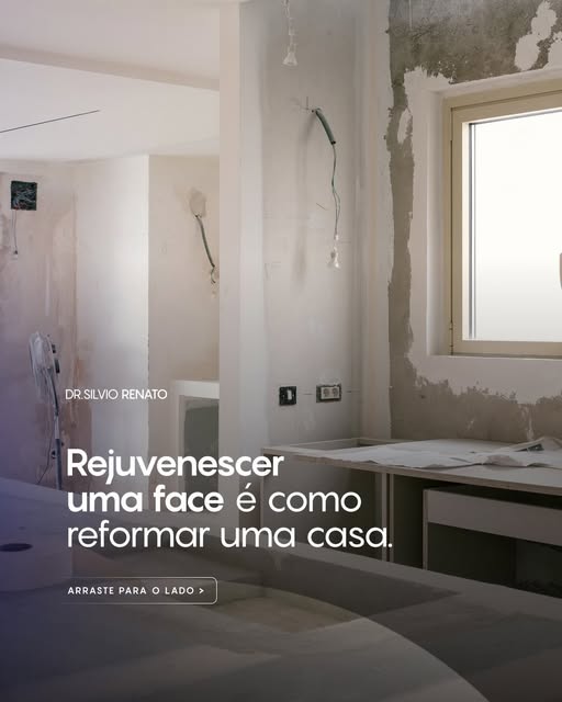 É comum chegar ao consultório perguntando qual é o melhor procedimento para rejuvenescer a face.
Mas