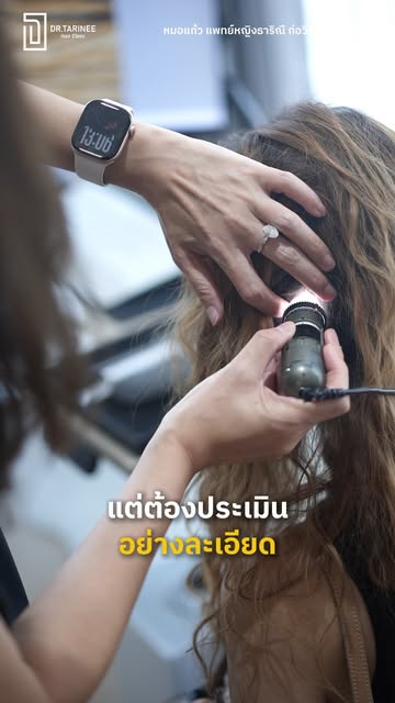 ปลูกผมทับ “รอยแผลเป็น” ได้ไหม? 👀
มาดูจากเคสคุณกั้งและคุณมินนี่กันค่ะ 

#ปลูกผม #หมอแก้ว 
#DrTarinee