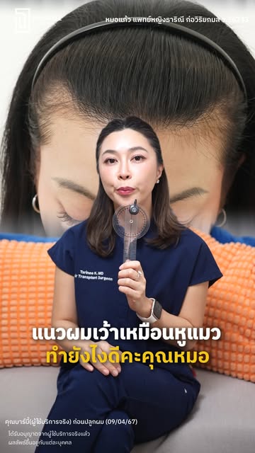 ผมผู้หญิง…ไม่ใช่ทุกจุดจะปลูกง่ายเหมือนกันนะ 👀
โดยเฉพาะบางบริเวณที่ต้องคิดทั้งทิศทาง 
ความหนาแน่น แล