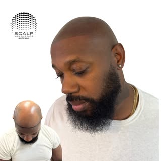 Flawless fade!!! The most natural, undetectable results where everyone will be asking who your barbe