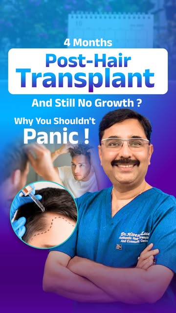 Hair Transplant after 4 months and still seeing very little hair growth? Don’t panic.

Hair Transpla