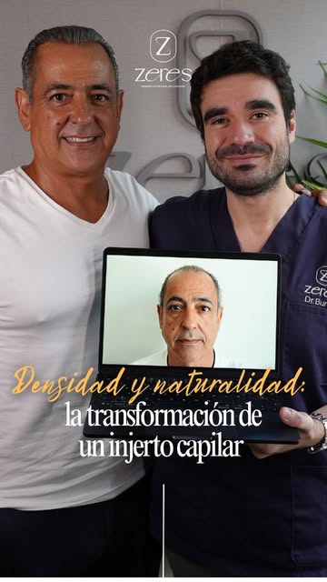 Un injerto capilar exitoso no solo busca recuperar el cabello, sino conseguir un resultado completam