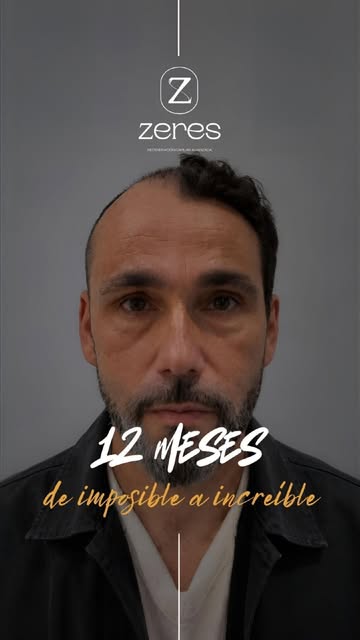 De la planificación a la realidad. ✨

Un diseño preciso y personalizado es la clave para lograr una 