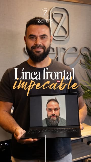 Un cambio que se nota, pero sobre todo, se siente. 🔥✨

Cuando la pérdida de densidad o la línea fro
