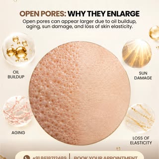 Open pores don’t appear overnight—and they won’t disappear with quick fixes either.

✨ Excess oil, s