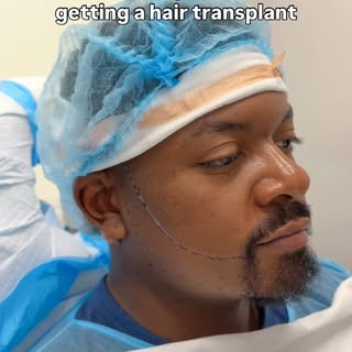 New beard who this? 👀 Did you know you could do a FACIAL hair transplant? 

Dr. Drummond has done i