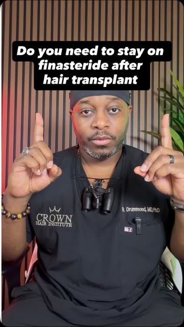 Do you need to be/stay on finasteride after hair transplant? No, but you do need to be on a DHT bloc