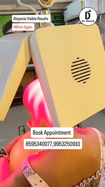 #alopeciaareata #naturalhairgrowth  #alopeciatreatment 
#hairlosstreatment