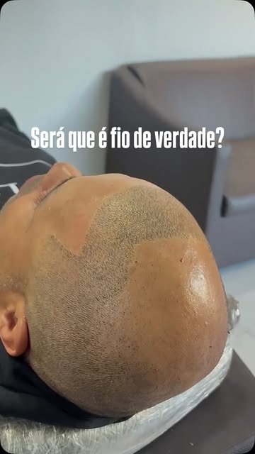 O fio a fio já faz parte da minha técnica.

Eu domino a execução e venho aprimorando uma abordagem p
