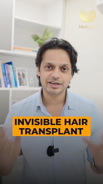 Hair transplant ke liye head shave karna compulsory hai?
Not necessarily.

Most hair transplant proc