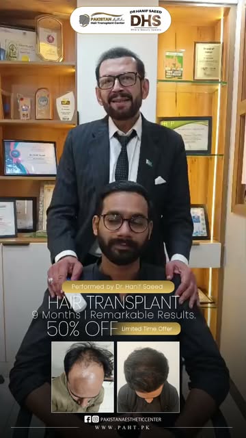 9 Months. Remarkable Results.
A successful hair transplant is about more than adding hair—it’s about