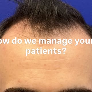 Hair Restoration Isn’t One-Size-Fits-All: Why a 25-Year-Old and a 35-Year-Old Need Different Plannin