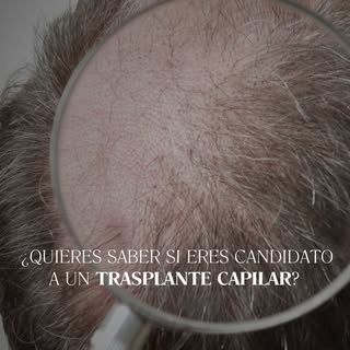 Hoy te cuento algunos de los aspectos que valoro en consulta antes de recomendar este tratamiento.

