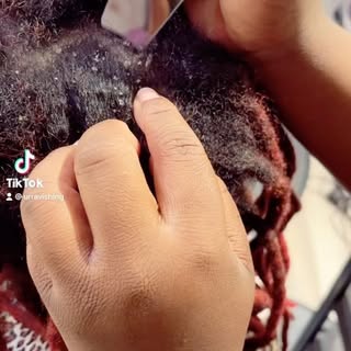 Does your scalp look like this? Let's get down to the root of the problem. See Trichologist Patricia