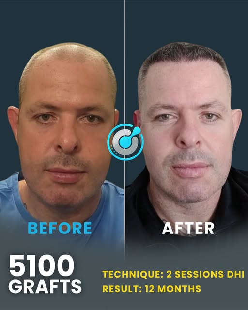 Not just haira whole new chapter.

This is the kind of result that comes from combining advanced tec