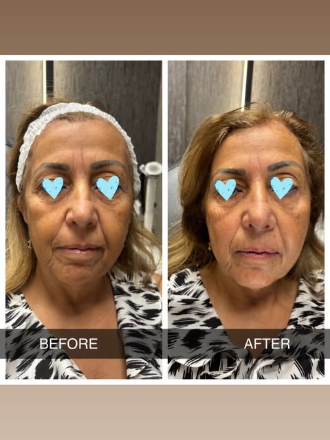 Finally got my hands on my MOM!!! She wanted to try the new Xerf….she loved it !🥰 #xerf  #plump @ro