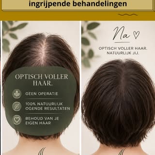 ✨ Voller haar, zonder ingrijpende behandelingen.

Dunner wordend haar betekent niet automatisch dat 