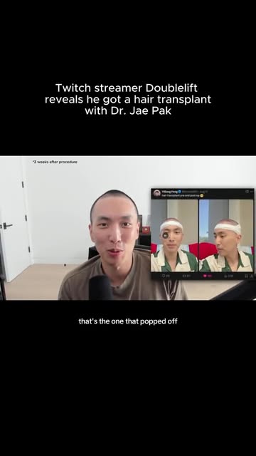 DoubleLift has been open about his experience with hair restoration with Dr. Jae Pak. As a professio