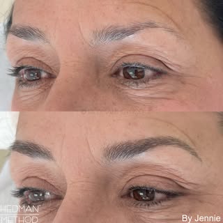 There’s something so satisfying about seeing beautifully healed results. 🤍

The first photo shows t