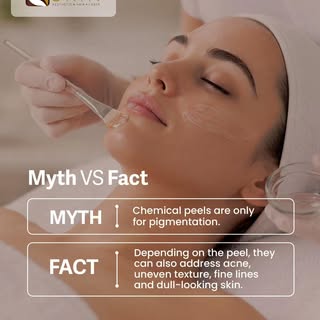 Chemical peels aren’t just about pigmentation. Depending on the type of peel, they can also help add