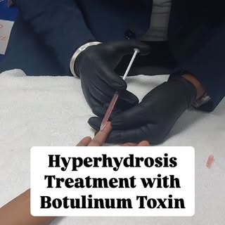 🎓Learn Hyperhydrosis(Palm) Treatment with Botulinum Toxin at IICAD Academy! 💉
✨ Our expert instruc