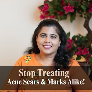 Acne scars and acne marks are different, and they need different treatments!

Acne marks are usually