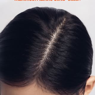 맘모스 헤어라인의원은 프라이빗한 공간에서 모발이식과 재생 치료를 함께 제공하는 탈모·항노화 특화 의료기관입니다.

모발이식센터는 대표원장 1인이 상담부터 디자인, 채취, 식모까지 