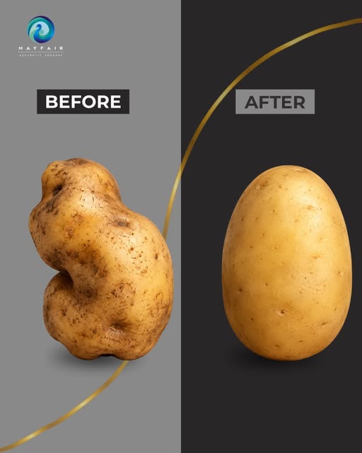If only transformations were as simple as switching vegetables. 👀🥔➡️🥔

In real life, every aesthe