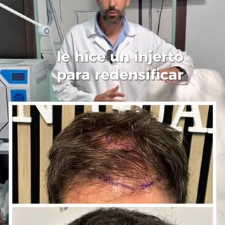 ✨ Este puede ser el momento que llevas tiempo esperando.

Si notas que has perdido densidad capilar 