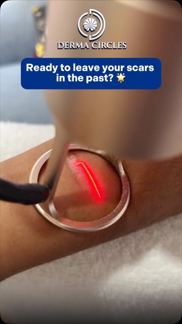 Is this the most oddly satisfying thing you’ll see today? 📐⚡

Watch this advanced laser break down 