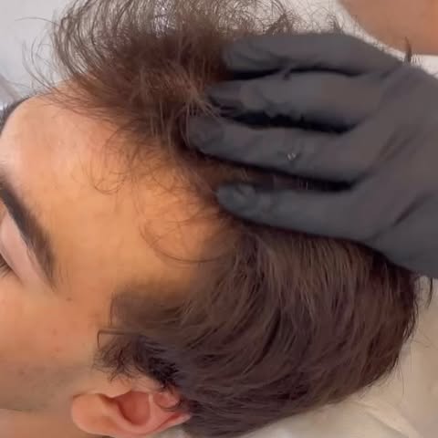 Sind Sie es leid, sich mit Haarausfall herumzuschlagen und wünschen sich dichteres und kräftigeres H