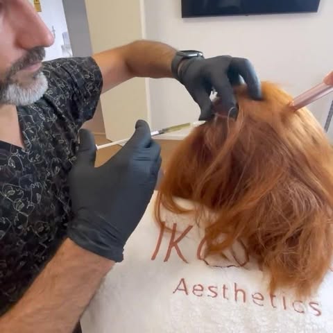 Die Lösung gegen Haarausfall: PRP-Behandlung 💆🏻‍♂️💆🏻‍♀️💉

Die PRP-Behandlung gegen Haarausfall 